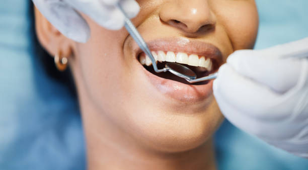 Best Teeth Whitening  in Clive, IA